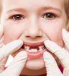 טיפול אנדודונטלי בשיניים צעירות עם אפקס פתוח -תמונה